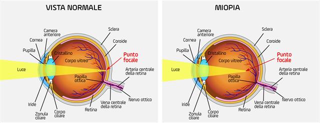 exercițiile oculare nu vor restabili vederea